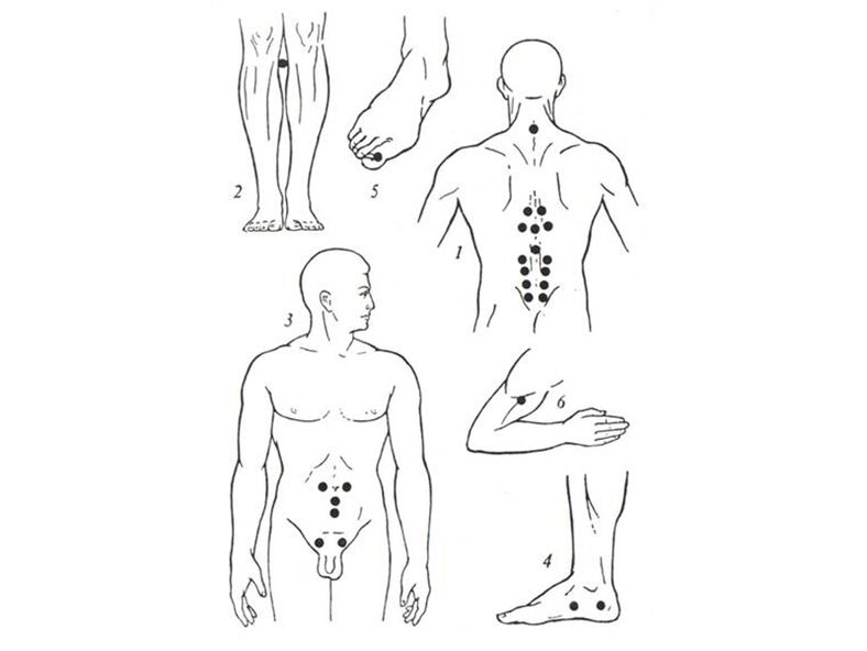Massage de l'acupuncture